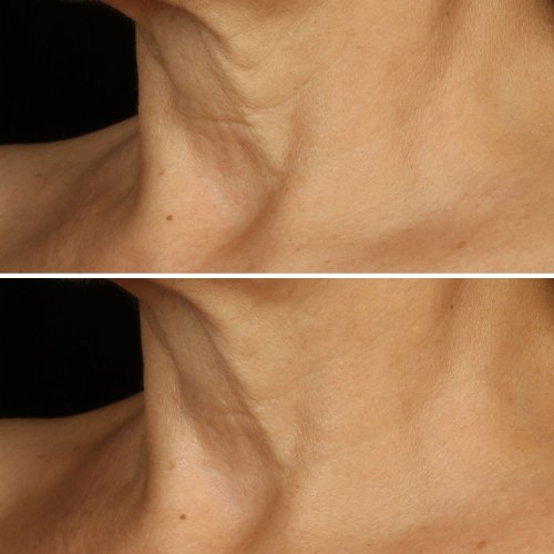 CLINIQUE Smart Clinical Repair - Crème Liftante Visage + Cou CLINIQUE Smart Clinical Repair - Crème Liftante Visage + Cou